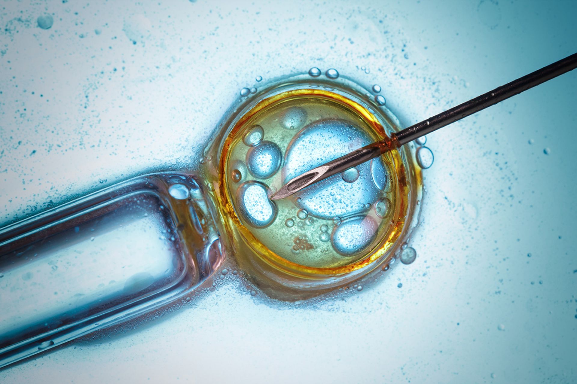 Infertility